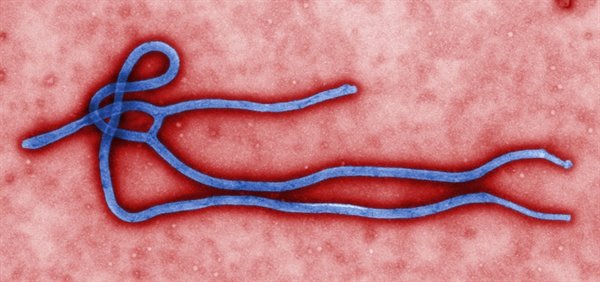 Virus del ébola